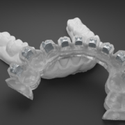 Digital Treatment Planning with OnyxCeph³ - Aligners and Indirect Bonding (Dublin)