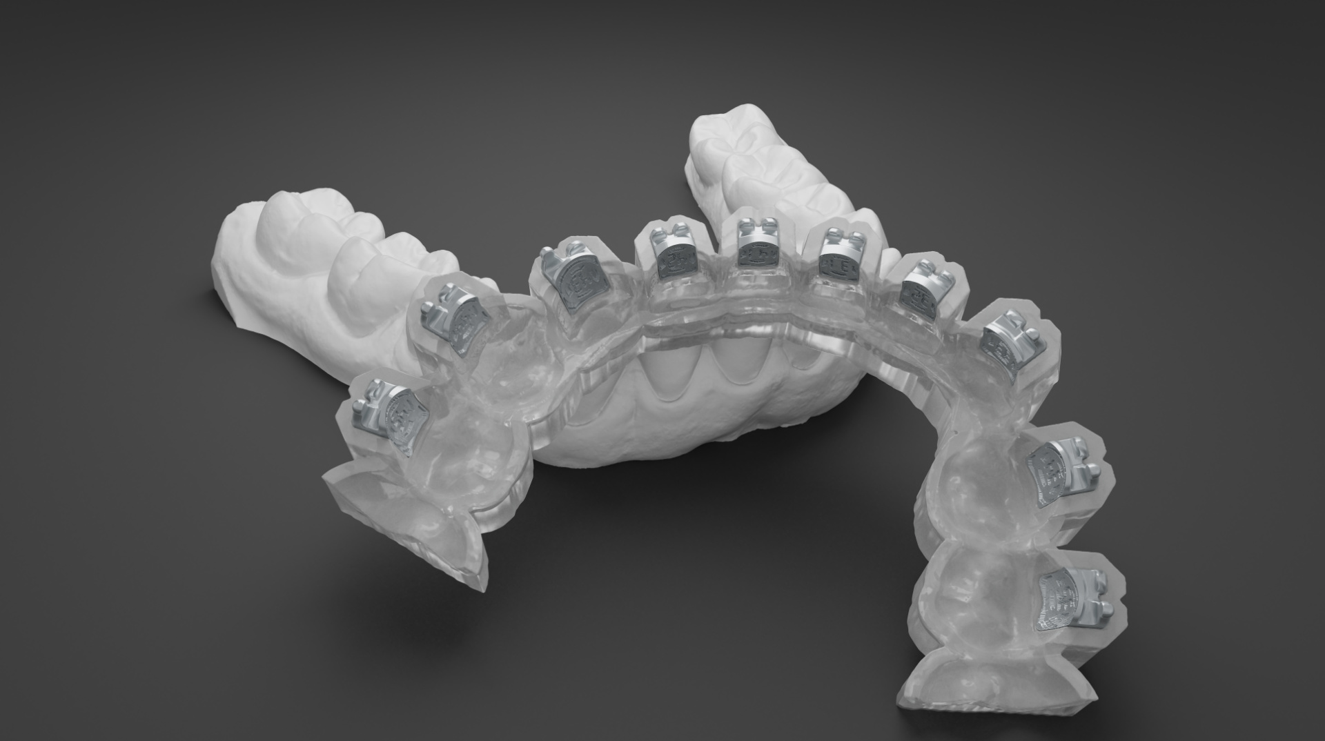 Digital Treatment Planning with OnyxCeph³ - Aligners and Indirect Bonding (Dublin)